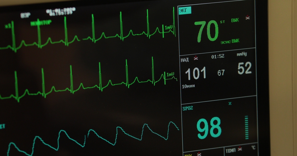 A heart monitoring device accurately depicts a patient's heart rate and respirations.